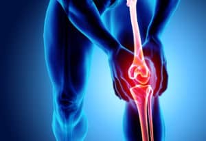 va disability rating for knee pain